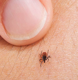 A small tick is crawling on skin near a fingernail. Beschreibung von KI generiert